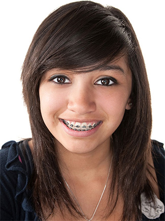 orthodontic faqs